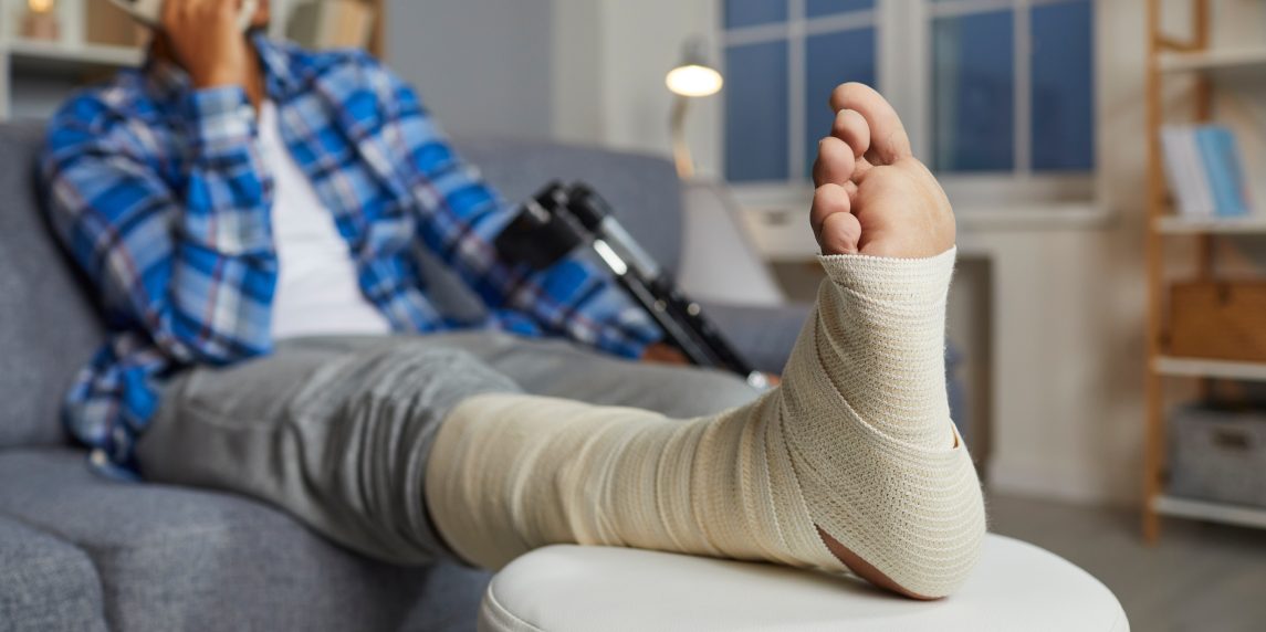 Close up of an injured foot. African American man talking on the mobile phone while relaxing on the sofa at home, with his foot and leg in a bandage resting on a stool. Physical injury concept